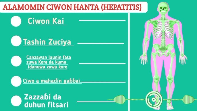Gargadin Jiki: Cikakken Bayani Kan Alamomin Ciwon Hanta da Yadda Za Ka Gane Su Tun Farko